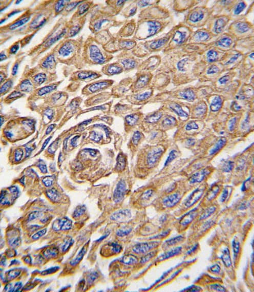 Polyclonal Rabbit anti-Human ALDH3A1 Antibody (aa254-284, IHC, WB)