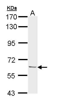 Polyclonal Rabbit anti-Human UBQLN1 / Ubiquilin Antibody (aa64-345, WB)