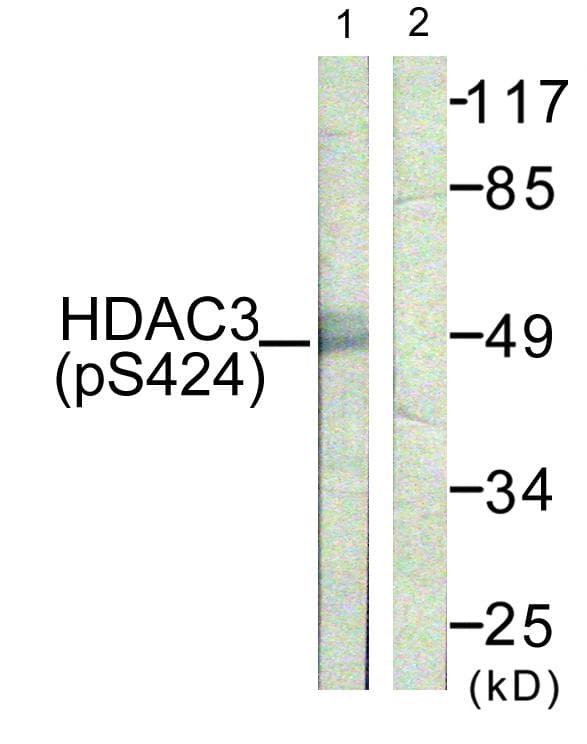 Polyclonal Rabbit anti-Human HDAC3 Antibody (phospho-Ser424, IHC, IF, WB)
