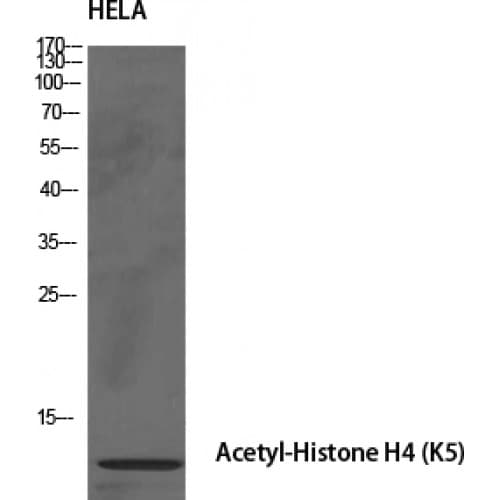 Polyclonal Rabbit anti-Human Histone H4 Antibody (1-80 aa, IHC, IF, WB)