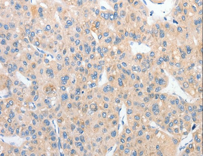 RPN1 / Ribophorin I Antibody