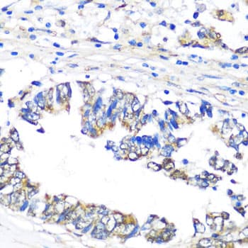 Polyclonal Rabbit anti-Human NAMPT / Visfatin Antibody (IHC, IF, WB)