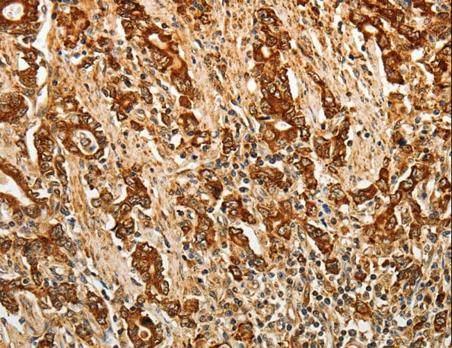Polyclonal Rabbit anti-Human AKR1B1 / Aldose Reductase Antibody (IHC, WB)
