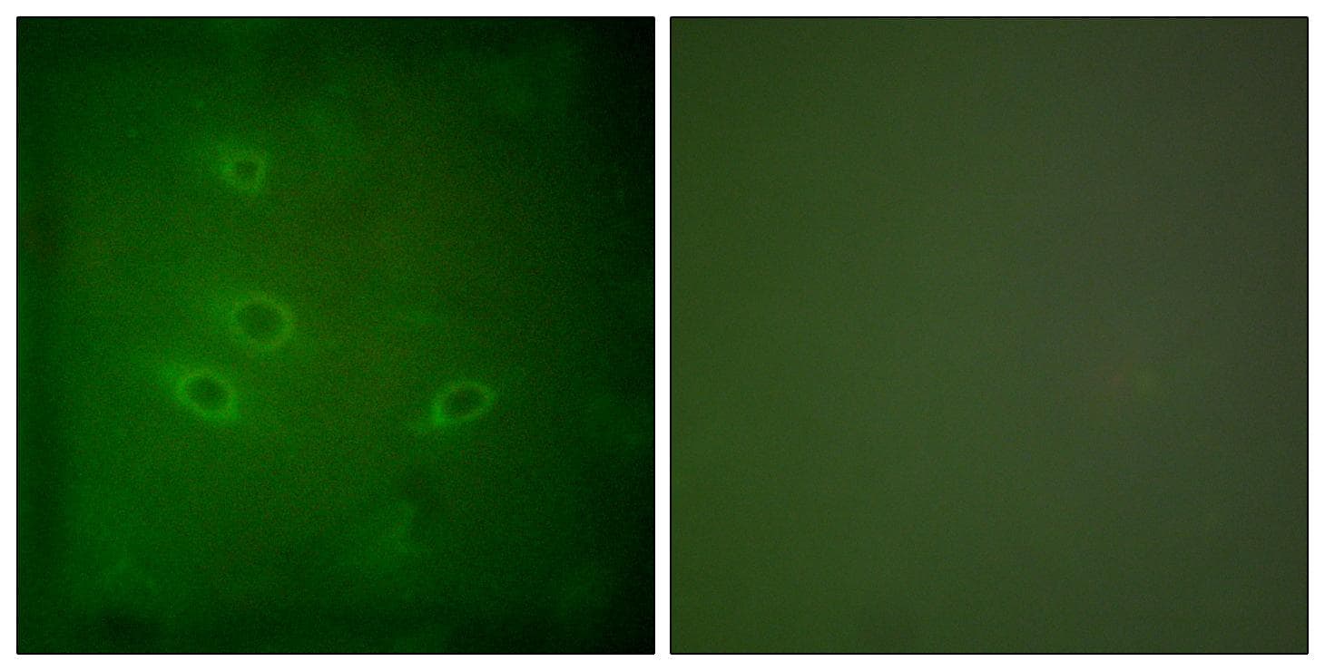 Polyclonal Rabbit anti-Human CARD6 Antibody (IHC, IF, WB)