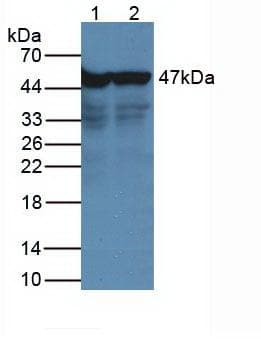 ENO2 / NSE Antibody (clone A4)