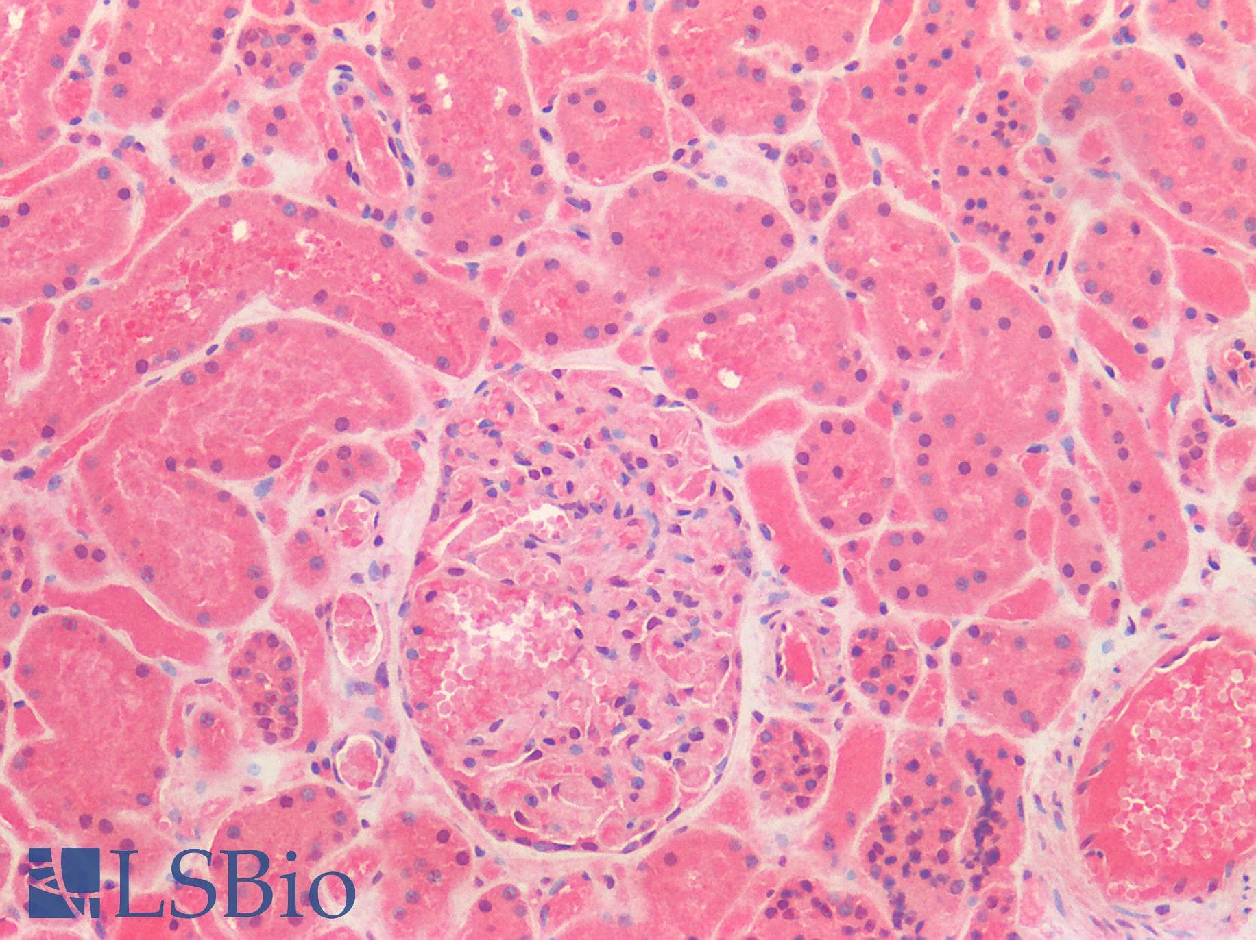 IHC-plus™ HGF / Hepatocyte Growth Factor Antibody