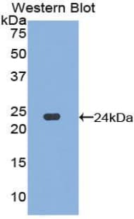 DVL1 / DVL / Dishevelled Antibody (aa150-332)