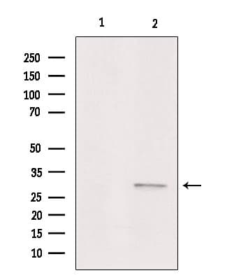 ACER1 / ASAH3 Antibody