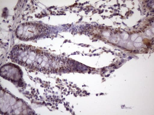 IKBKE / IKKI / IKKE Antibody (aa474-716, clone OTI3C5, Carrier-free)