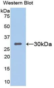 SIRT1 / Sirtuin 1 Antibody (aa236-490, PE)