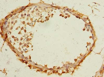 TMEM186 Antibody