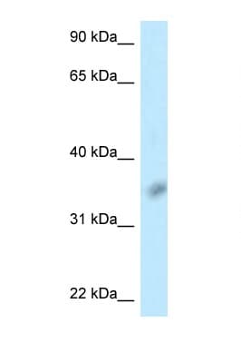 BTLA / CD272 Antibody (aa111-160, Biotin)