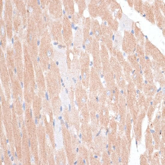 Polyclonal Rabbit anti-Human KATNA1 Antibody (IHC)