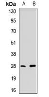 PDC Antibody