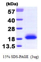 Human VILIP / VSNL1 Protein (Recombinant)