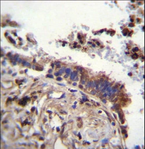 TTBK2 Antibody (aa217-245)