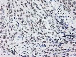 MGLL / Monoacylglycerol Lipase Antibody (clone OTI1C6)