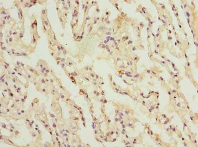CCDC181 / C1orf114 Antibody (Coiled-coil domain)
