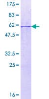 Human ECH1 Protein (Recombinant GST)