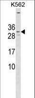 KCNE4 Antibody (aa58-86)