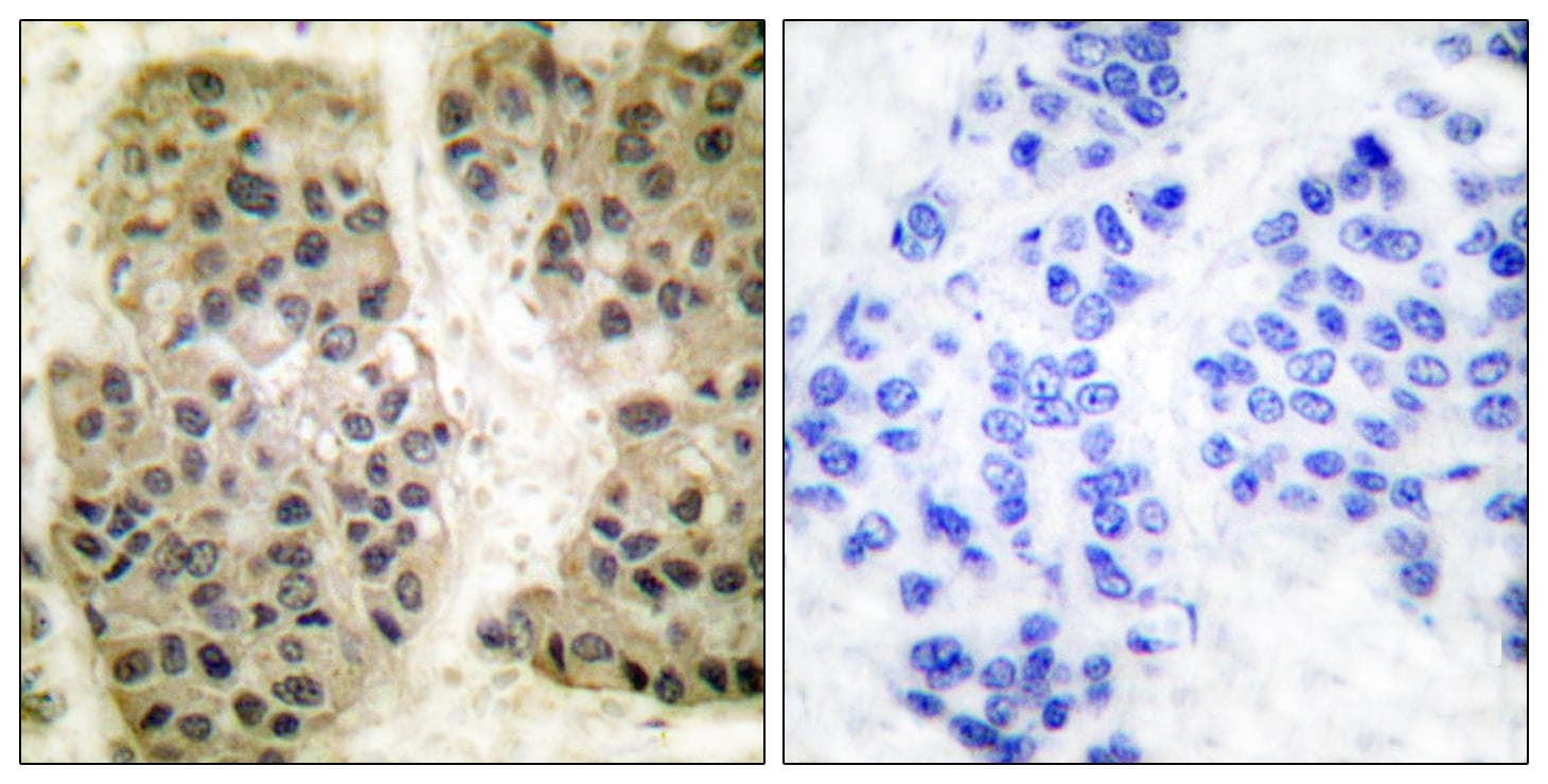 Polyclonal Rabbit anti-Human MCM3AP / GANP Antibody (IHC, WB)