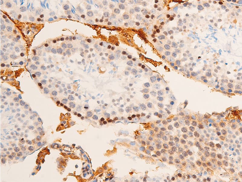 Polyclonal Rabbit anti-Human JUN / c-Jun Antibody (phospho-Tyr170, IHC, WB)