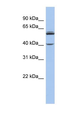 Polyclonal Rabbit anti-Human CYP4V2 Antibody (aa431-480, WB)