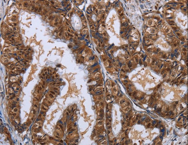 LTA4H / LTA4 Antibody