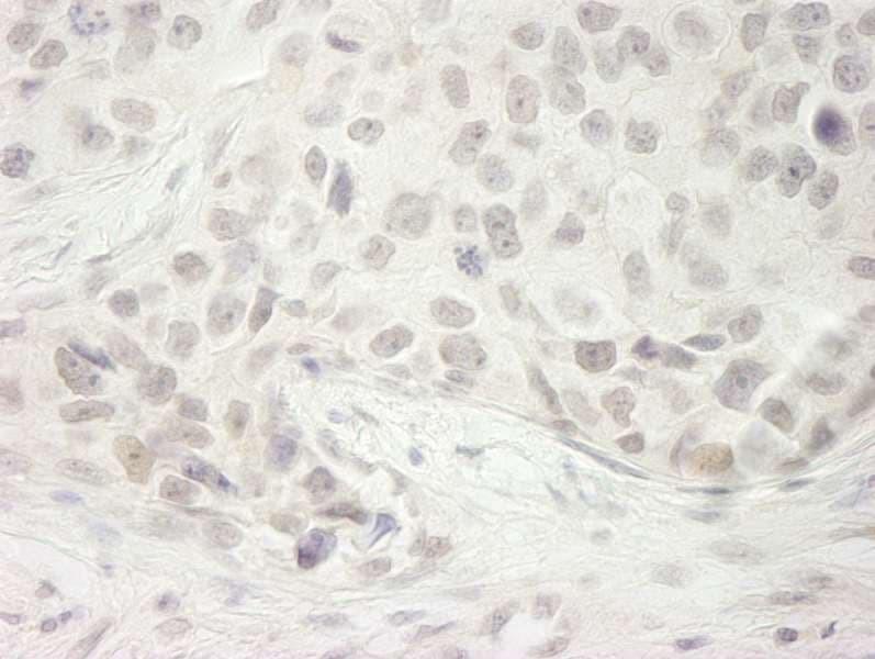 Polyclonal Rabbit anti-Human DDX33 / DHX33 Antibody (aa1-50, IHC)