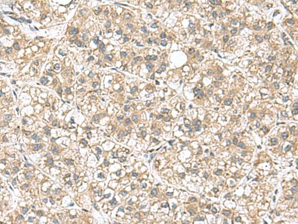 PAPSS2 Antibody