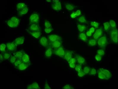 Polyclonal Rabbit anti-Human KLHL20 Antibody (IHC, IF)