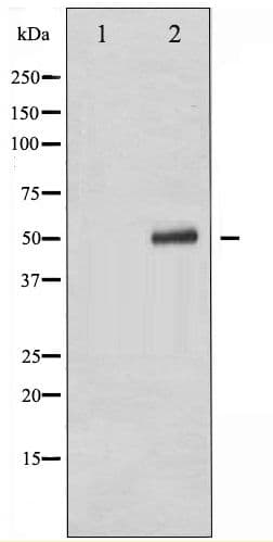 TP53 / p53 Antibody (phospho-Ser392)