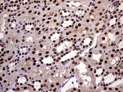 XRN2 Antibody (aa677-779, clone OTI5F4)