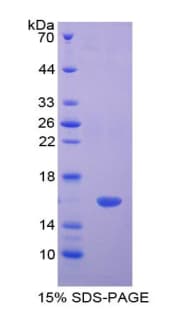 Rat LGALS2 / Galectin 2 Protein (Recombinant His-T7)