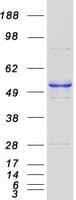 Human HARS2 Protein (Recombinant Myc-DDK (Flag))