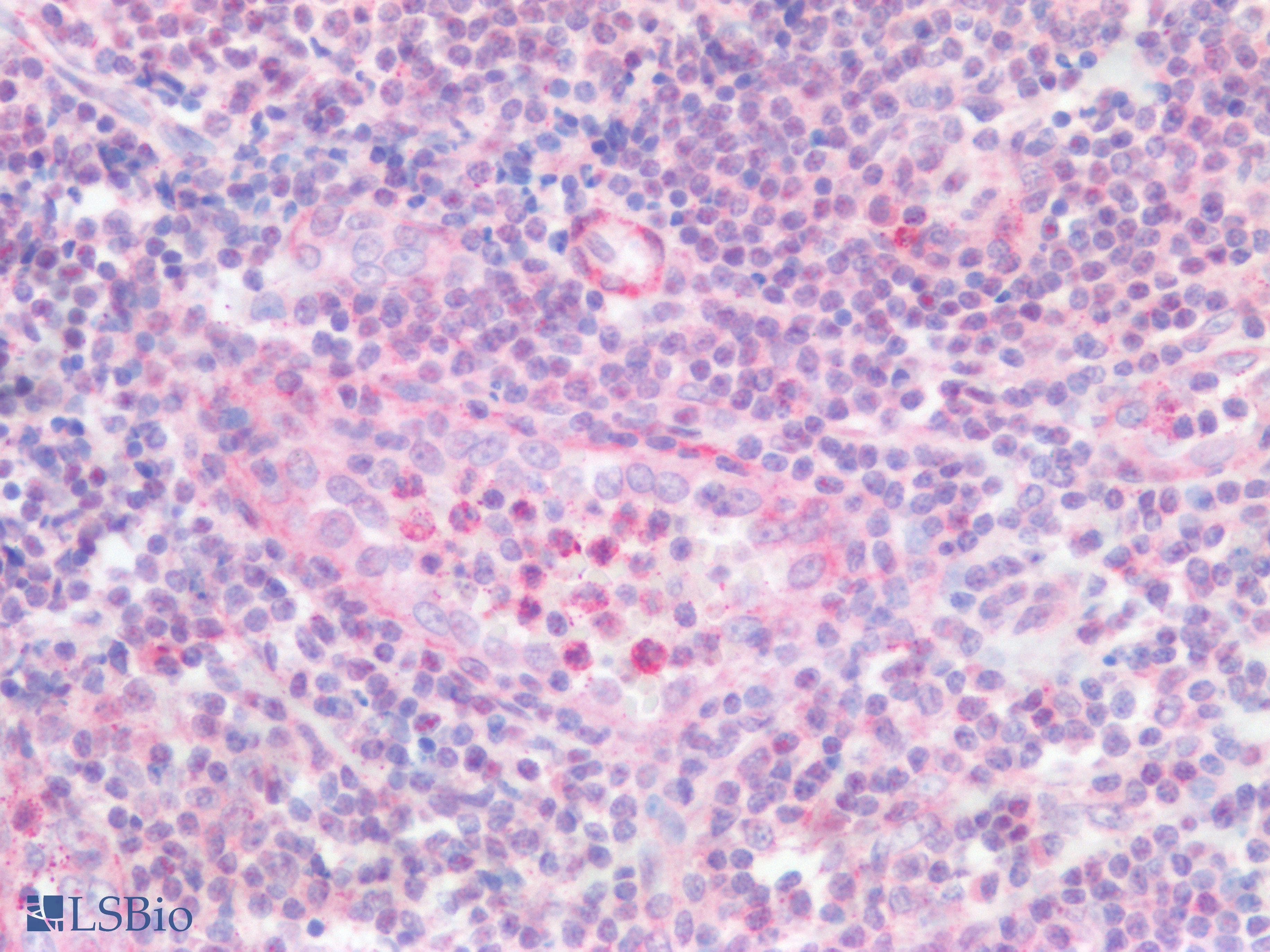 PLCB2 Antibody