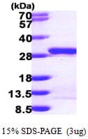Human MESDC2 / MESD Protein (Recombinant His)