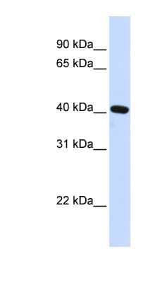 Polyclonal Rabbit anti-Human SIRT4 / Sirtuin 4 Antibody (aa36-85, WB)