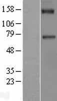 F11 / FXI / Factor XI Protein (Over-Expression Lysate Myc-DDK (Flag))