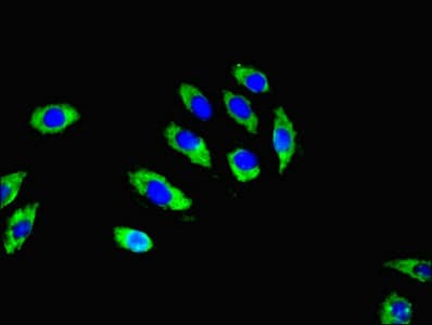 RGS20 / RGSZ1 Antibody (aa1-241)
