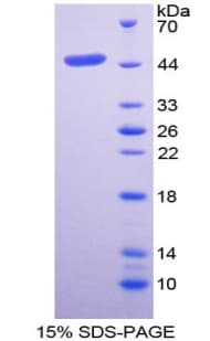 Mouse TSLP Protein (Recombinant His-GST)