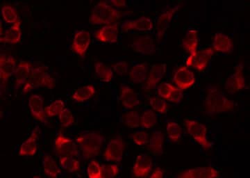 FASTKD1 Antibody