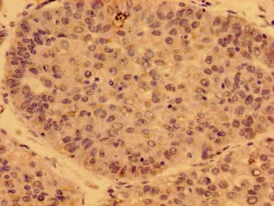 PDF / PLAB Antibody