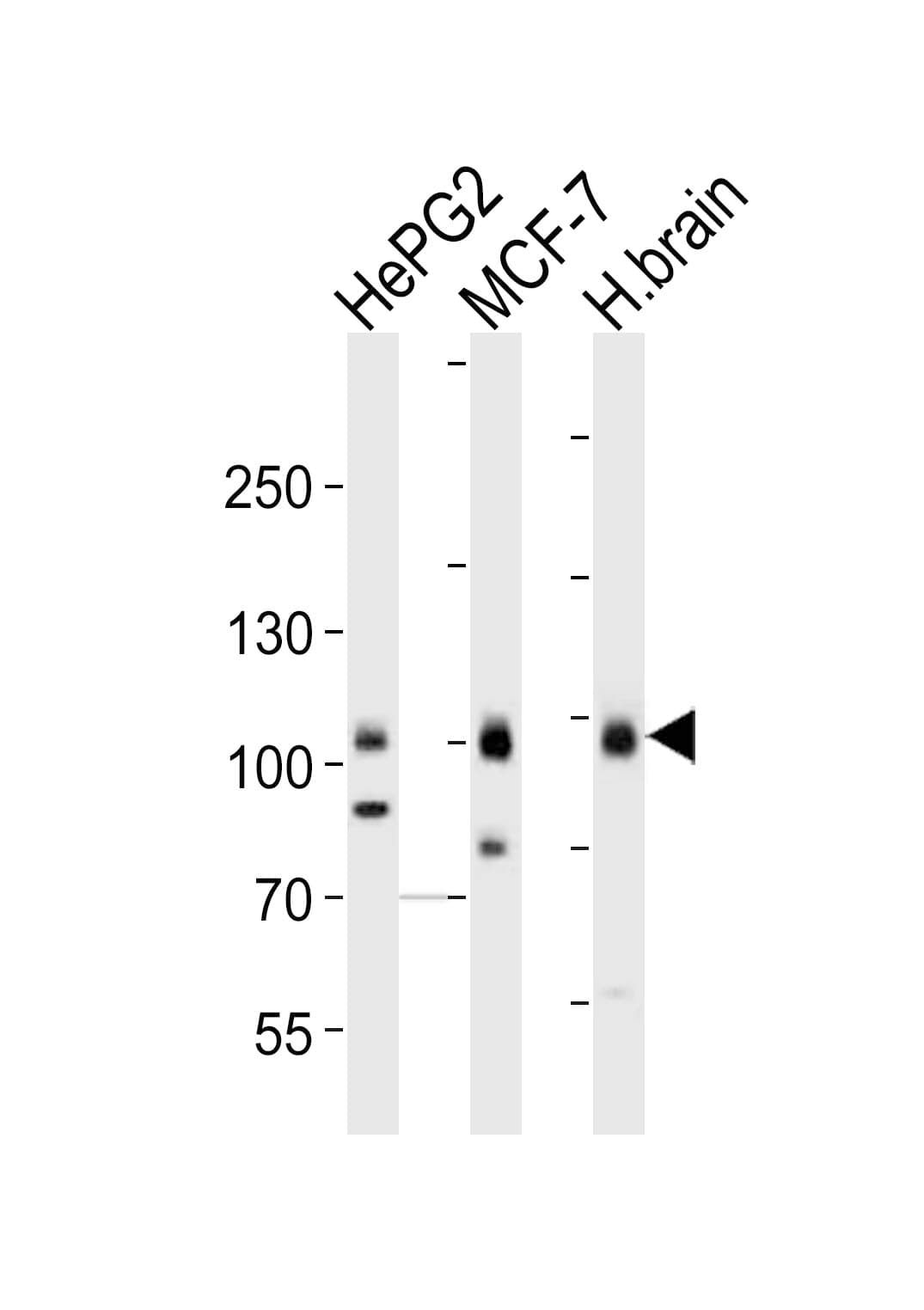 TLE1 / TLE 1 Antibody (aa187-221)