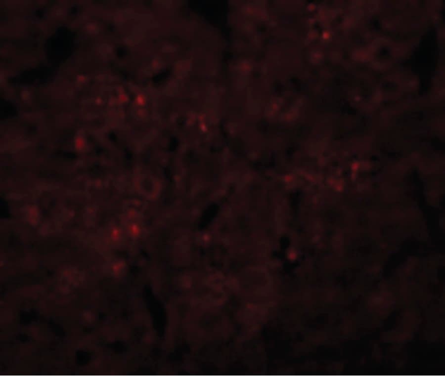 SYNGR3 / Synaptogyrin 3 Antibody