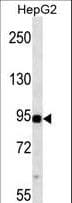 IHC-plus™ MAP3K11 / MLK3 Antibody