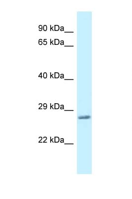 VAMP7 / SYBL1 / T1 VAMP Antibody (aa134-183)