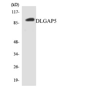 HURP / DLGAP5 Antibody (aa780-829)