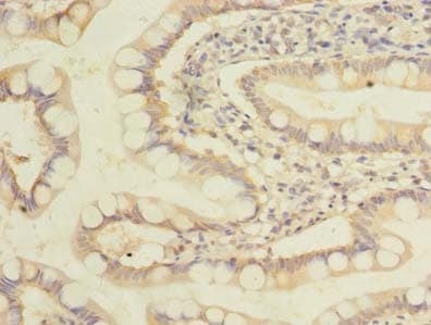 IHC-plus™ Polyclonal Rabbit anti-Human ZDHHC3 Antibody (IHC, WB)