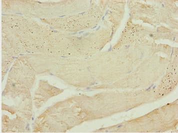 Polyclonal Rabbit anti-Human CALCOCO2 Antibody (IHC, WB)